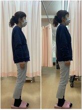 仙台りんく整骨院/骨格矯正　before after