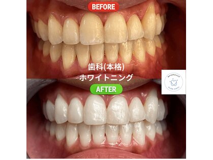 グロウ 東区香椎(GLOW)の写真