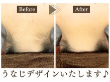 エステティック レイビス 青森店(RAYVIS)/後ろ美人に♪