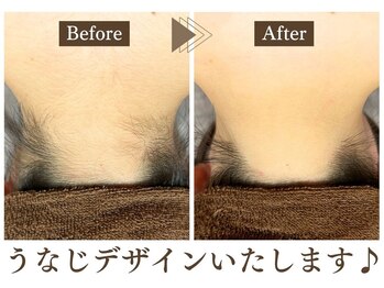 エステティック レイビス 青森店(RAYVIS)/後ろ美人に♪