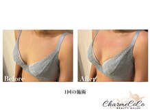 シャルムココ 蔵前店(CharmeCoCo)/お客様Before→After