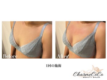 シャルムココ 蔵前店(CharmeCoCo)/お客様Before→After