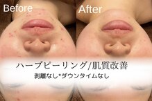 ザ リノビューティー 自由が丘店(The Lino Beauty)