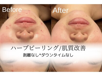 ザ リノビューティー 自由が丘店(The Lino Beauty)の写真