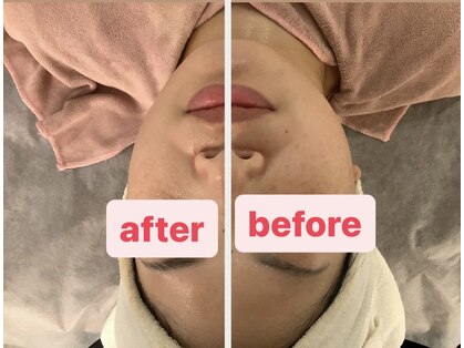 ボディデザイン ビィーラボ(BODY Design BE Labo)の写真