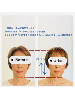 ビューティートワブルームサロン(Beauty Towabloom Salon)/表情筋ほぐし耳ツボで小顔に変身