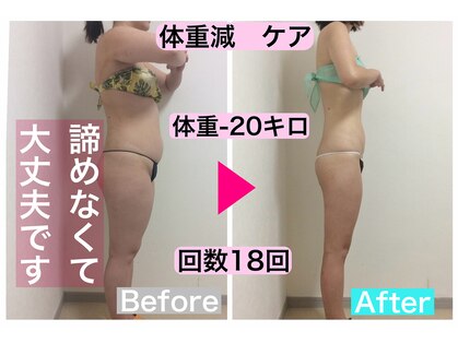 マッチ(much)の写真