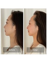 ティセ(TisseR)/面長も卒業！