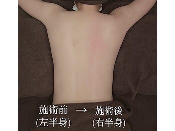 ラースパ アザブ(La SPA azabu)/凝りと浮腫みが剥がれ落ちる技術