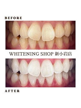 ホワイトニングショップ 新小岩店/ホワイトニング専門店