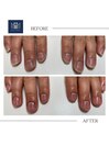 【ネイルケア】before/after