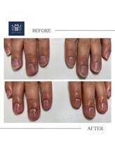 メンズメイド(Mens'Made)/【ネイルケア】before/after