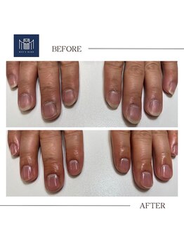 【ネイルケア】before/after