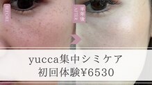 ユッカ(yucca)