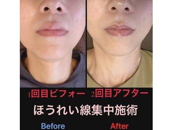 美容矯正サロン レレポノ(LELEPONO)/