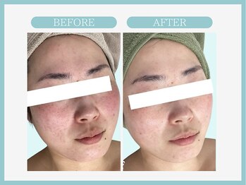 スリムライン 弘前店(The Slim Line)/before→after