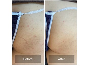 素肌研究所BSラボ/