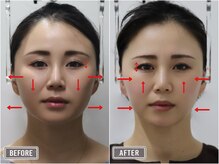 さつま骨格矯正 表参道青山院/歪み小顔矯正＋骨盤矯正