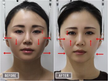 さつま骨格矯正 表参道青山院/歪み小顔矯正＋骨盤矯正