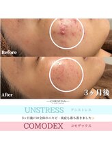 フルアナ(Hu ruana)/フェイシャルエステ