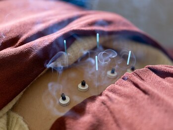 望鍼灸院/慢性腰痛専門鍼灸