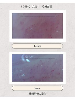 ぷめはな整体/before/After