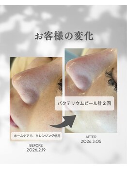 ココフルール(Cocofleur)/お手入れ2回