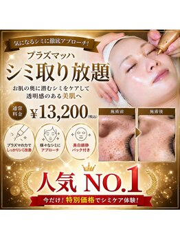 ミナミ(MINAMI)の写真/諦めていたシミを改善！【60分間シミケア放題★￥4980】気になるところを思う存分♪プラズマッハで速攻撃退