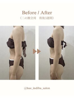 ヒューインディバサロン 横浜(HUE INDIBA SALON)の写真/美容施術後、どこでケアするか迷っている方へ