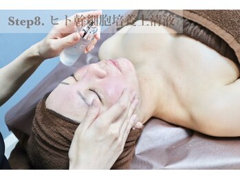 ノーブル 新宿南口(NOBLE)/剥ハーブピーリング　工程8