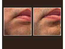 スパロウ(RF sparrow)/４９歳　男性