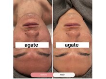 アガットバイミヤモト(agate by miyamoto)/ビフォーアフター