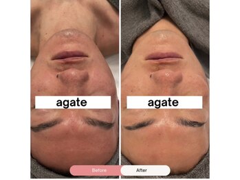 アガットバイミヤモト(agate by miyamoto)/ビフォーアフター