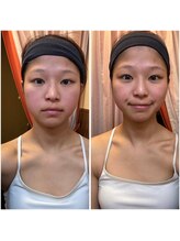 ドクタージェーナ(Dr.Jena)/お客様before/after