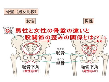 小池整体院/骨盤の違いと股関節の歪み?