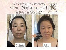 カルマ(KARMA)