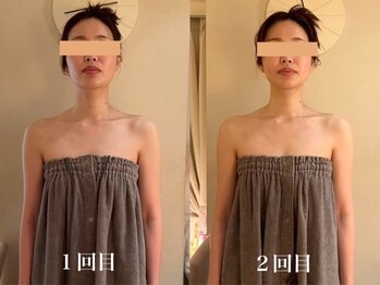 カオン(kaon)/ブライダルエステ2回のお客様