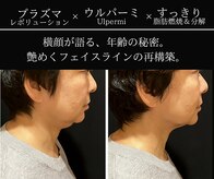 小顔ウナ学芸大学店(UNA)