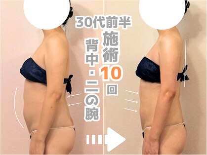 ティセラ(TISERA.)の写真