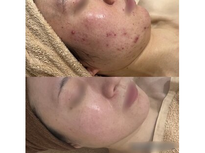 リンダ(Rinda)の写真