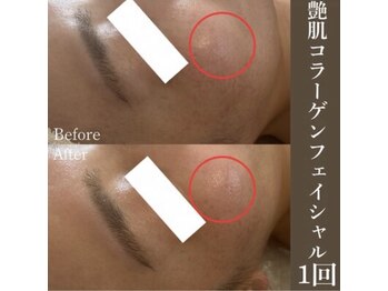 サロンドペシェ(salon de peche)/艶肌コラーゲンフェイシャル1回