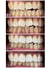 コナホワイトニング 神保町/御茶ノ水駅ホワイトニング