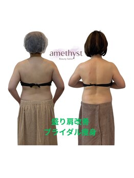 アメジスト(amethyst)/ブライダル痩身×盛り肩改善