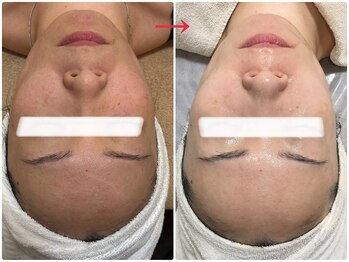 オージャス(OJAS)/40代の方　艶肌ノーファンデに！