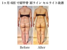 ナチュラーレ 天王寺店(Naturale)/痩身リンパマッサージ二の腕美脚