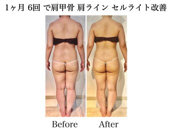 ナチュラーレ 天王寺店(Naturale)/痩身リンパマッサージ二の腕美脚