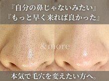 アンドモア(&more)