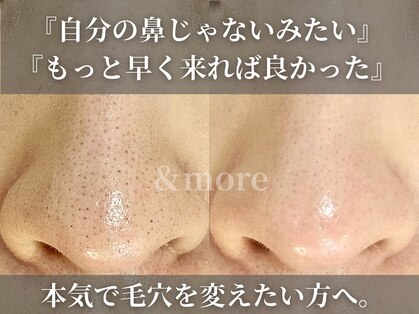 アンドモア(&more)の写真
