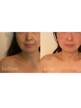 ラズ(Luz)/【小顔60分コース】