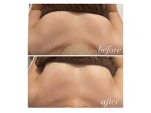 オークツリー(oak tree)/ぷるんぷるんバストケア